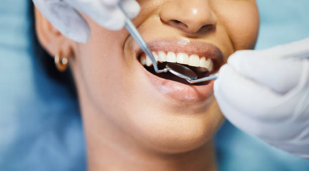 Laser Dentistry in Dublin, PA